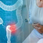 Colon & Rectal Cancer Screening